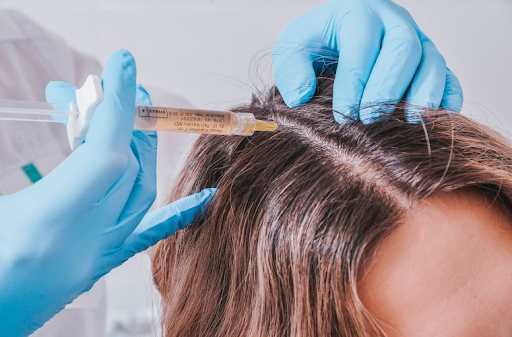 Как остановить выпадение волос? Делаем уколы мезотерапии
